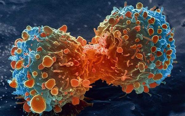 Estudio permite penetrar en los secretos genéticos del cáncer