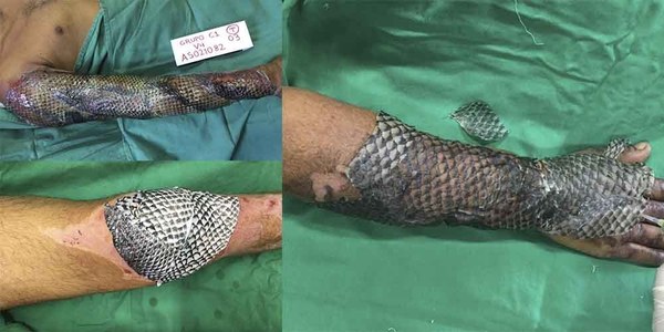 LA TILAPIA: EL PEZ QUE PUEDE CURAR QUEMADURAS Y QUE REVOLUCIONÓ LA MEDICINA EN BRASIL