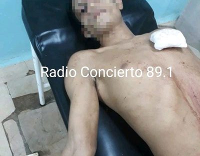 Ronda de tragos termina con un herido