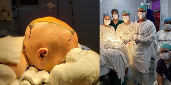 EXITOSA  PRIMERA CIRUGÍA CRANEAL POR ENDOSCOPÍA EN EL IPS