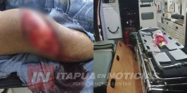 SE REVENTÓ LA RODILLA AL CAER DE SU MOTOCICLETA