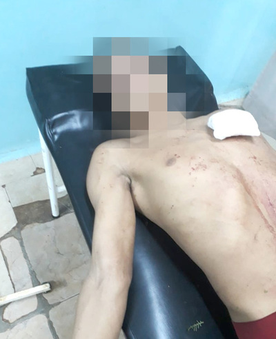 Adolescente es herido en el pecho durante pelea tras ronda de tragos