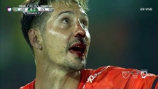 Jonathan Fabbro sufre fractura de nariz por codazo en México (Vídeo) - PARAGUAYPE.COM