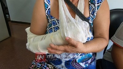 ABUELA SE CAYÓ EN EL COLECTIVO Y SE FRACTURÓ LA MUÑECA