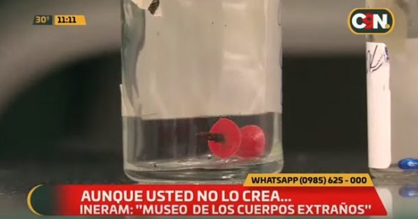 El INERAM revela los insólitos objetos tragados por pacientes