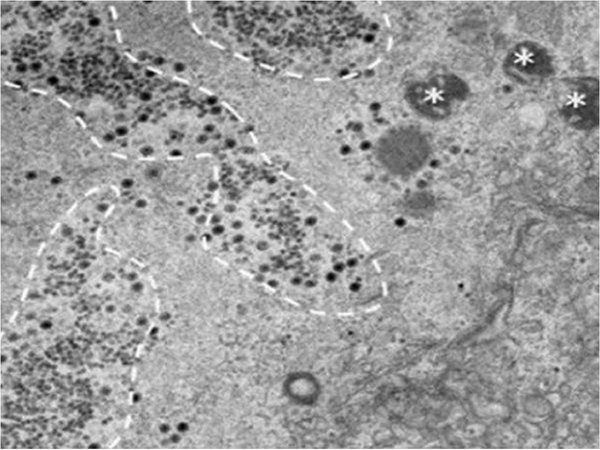 Científicos descubren misterioso virus inocuo para humanos en Brasil