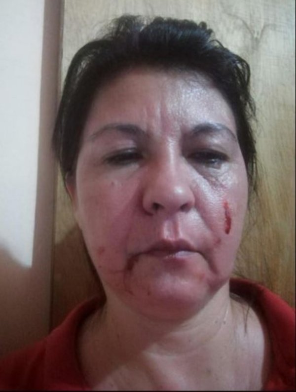 Chofer le encajó feroz puñetazo a pasajera