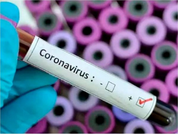 En Argentina desarrollan test para detectar coronavirus en una hora