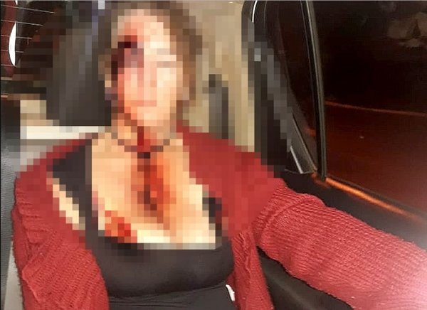 Detienen a un hombre por golpear brutalmente a su pareja | Info Caacupe