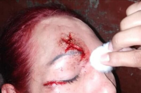 Cuatro hombres golpearon con varilla de hierro a un travesti | Info Caacupe