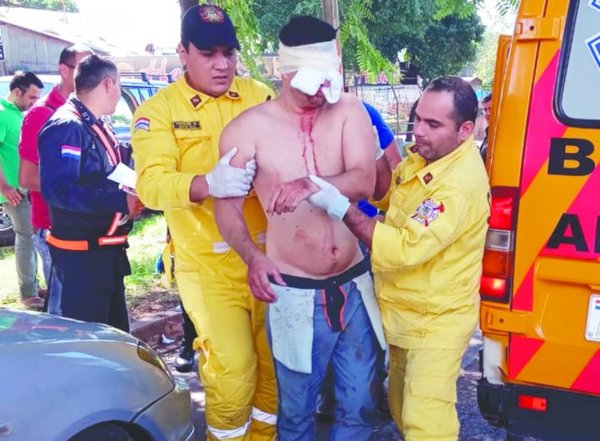Fue por drama amoroso que el brasileño se arrancó el ojo | Info Caacupe
