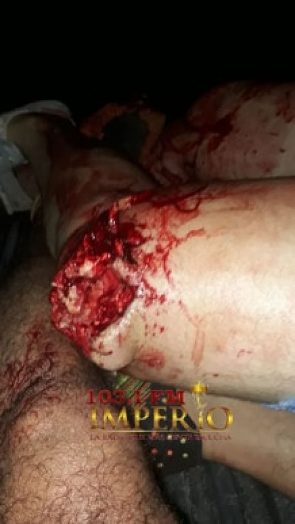 Tras partido de fútbol, se desató balacera con un muerto y heridos en Capitán Bado