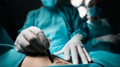 Mitos sobre la cirugía estética