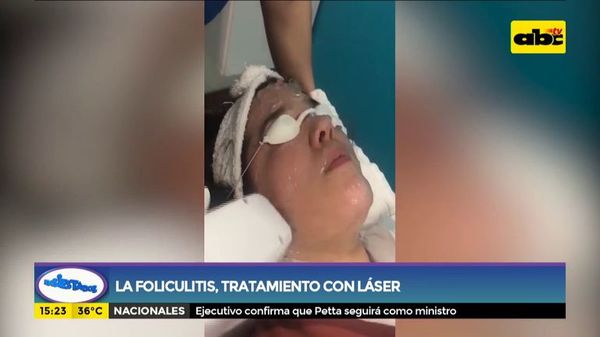 ¿Cómo tratar la foliculitis? - Ensiestados - ABC Color