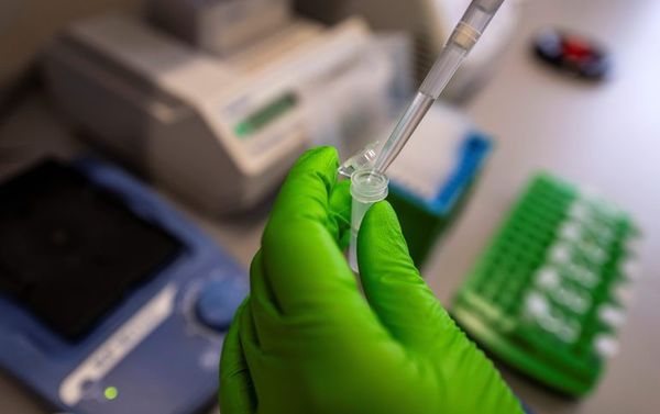 Test rápido de dengue en la Facultad de Química de la UNA - Nacionales - ABC Color