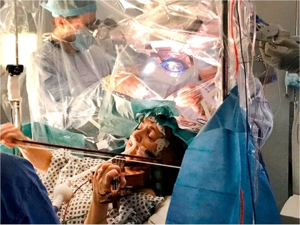 Una mujer toca un violín mientras le extirpan un tumor cerebral