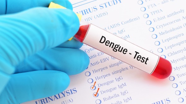 Ofrecen análisis de dengue en la facultad de Química de la UNA » Ñanduti