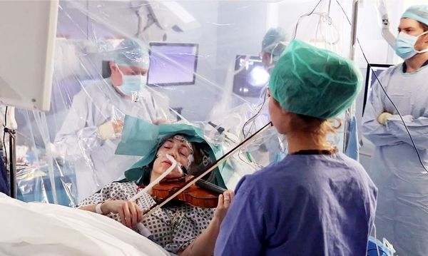 Ejecuta el violín durante  su operación de cerebro - Internacionales - ABC Color