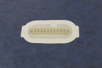 DISPOSITIVO PARA CERRAR HERIDAS SIN SUTURA PROMETE REVOLUCIONAR CIRUGÍAS