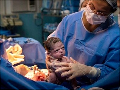 La imagen de la bebé que nació con cara de enojada y se volvió viral
