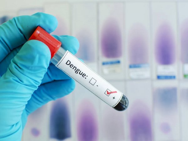 Dieta liviana y no beber alcohol, tips para superar el posdengue