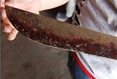 ¡De terror! madre hiere de un machetazo a su hija | Noticias Paraguay