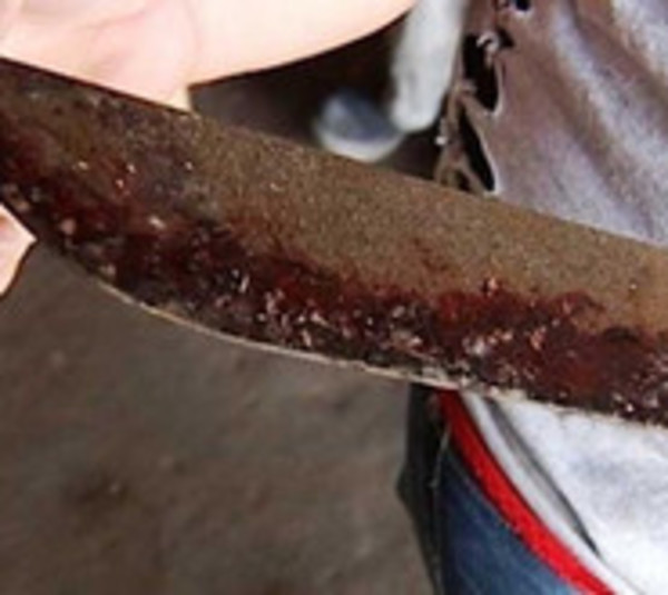 Caaguazú: Madre da un machetazo en la cabeza de su hija - Paraguay.com