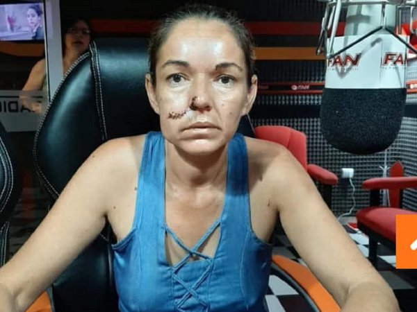 Irracional odio: por ser paraguaya pareja argentina le reventó y clavó