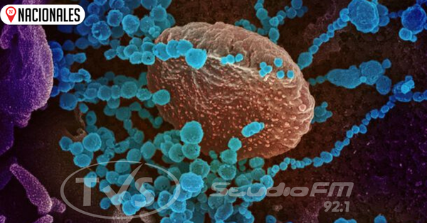 Coronavirus: Compatriota está en su casa, pero con restricciones para salir