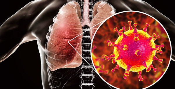 Fiebre, tos y dificultad para respirar, son signos y síntomas del coronavirus - Noticde.com