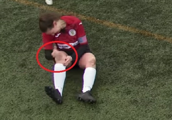 Escalofriante: Futbolista "arregla" su rodilla a golpes y sigue jugando