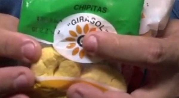Estudian con 3 chipitas en el estómago | Noticias Paraguay