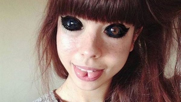 Modelo pierde la visión tras tatuarse los ojos en color negro