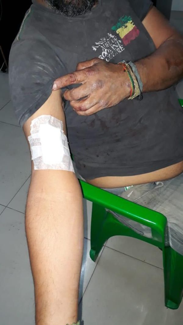 Dice que evitó asalto a pedradas y terminó herido - Nacionales - ABC Color