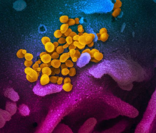 Nueva Zelanda confirma el primer infectado con el coronavirus en el país - Mundo - ABC Color