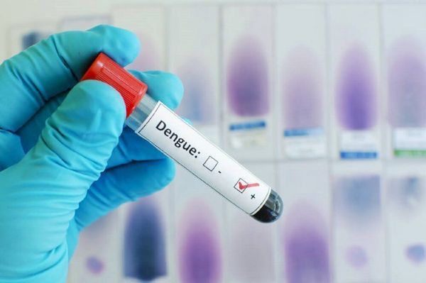 Dieta liviana y no beber alcohol, tips para superar el posdengue - Digital Misiones