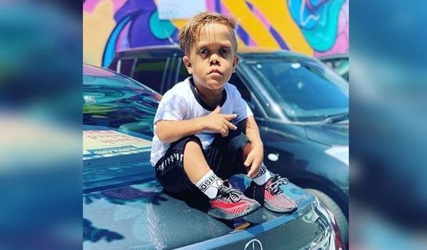 Aseguran que el niño con enanismo víctima de bullying es en realidad un influencer de 18 años de edad - Digital Misiones