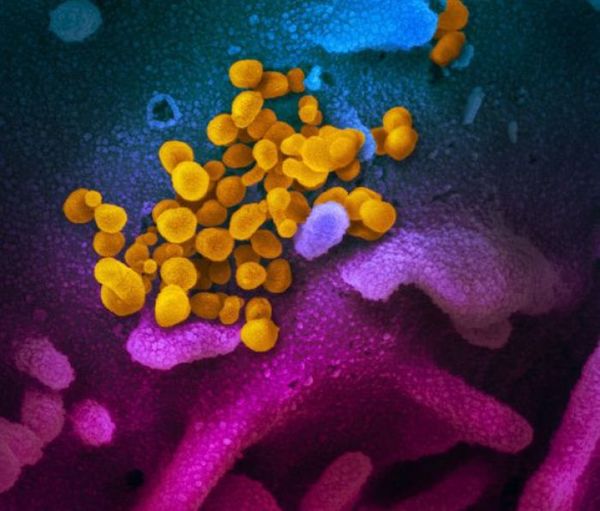 Israel afirma que desarrolló una vacuna contra el coronavirus