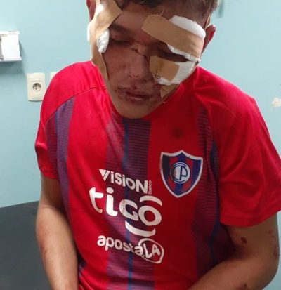 Detienen a delincuente tras protagonizar accidente