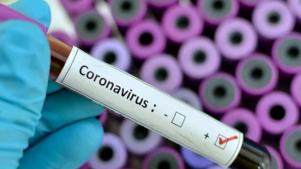 CONFIRMARON EL PRIMER CASO DE CORONAVIRUS EN LA ARGENTINA