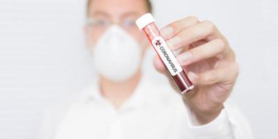 Primer caso de coronavirus en Argentina provino de Italia