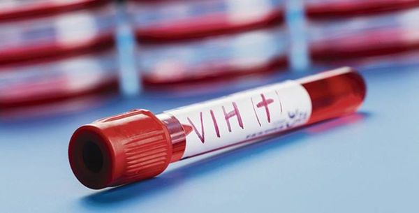 Presentarán proyecto latinoamericano para respuesta al VIH