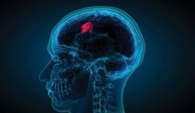 La ciencia abre una nueva vía contra los tumores cerebrales más agresivos