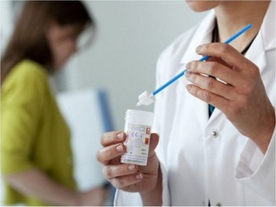 El 60% de mujeres se hacen el  PAP cuando están con cáncer avanzado