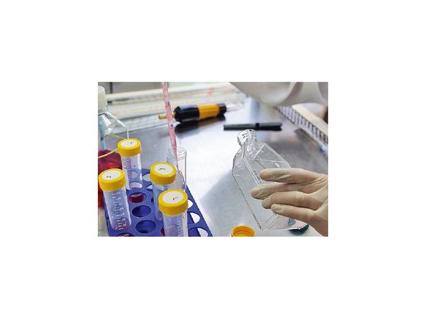 Con prueba de orina logran detectar el cáncer de próstata