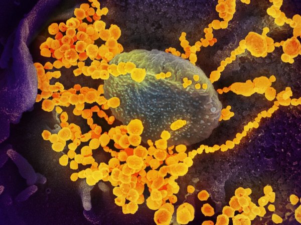 Sudáfrica confirma primer caso de coronavirus