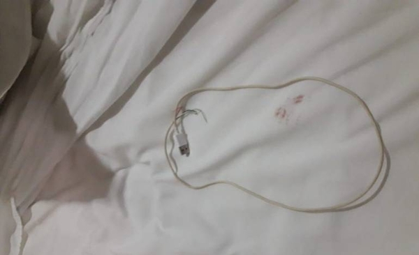 HOY / Intento de feminicidio en el Este: agresor usó un cable