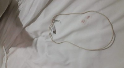Intento de feminicidio en el Este: agresor usó un cable
