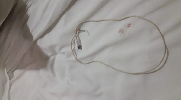 Intento de feminicidio en el Este: agresor usó un cable