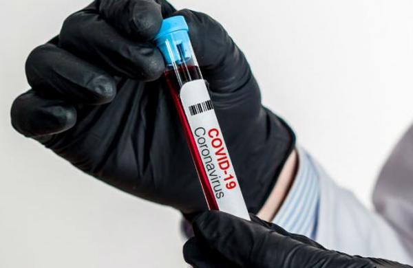 Ofrecen 4.500 dólares a voluntarios que se dejen infectar con coronavirus para hallar la cura - C9N